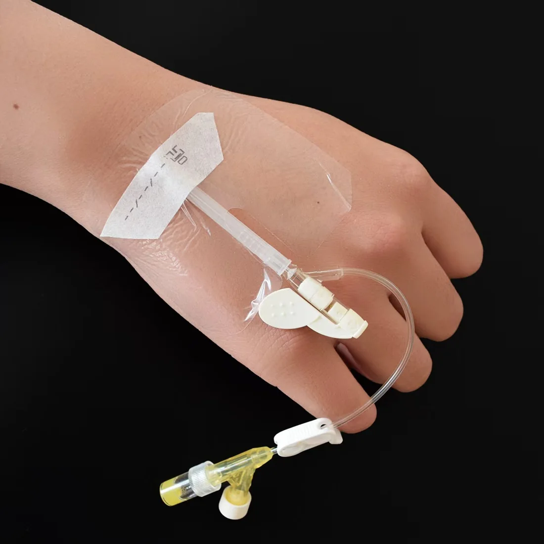 Apósito IV transparente aplicado sobre la mano, cubriendo y fijando un catéter periférico